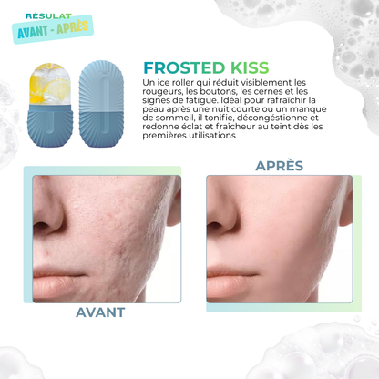 FROSTED KISS